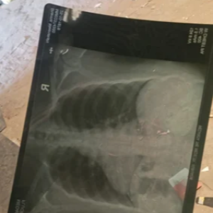 X RAY FILM WASTE Plastic Waste Reprocess Granule Mix Scrap sivasagar assam india Plastic4trade