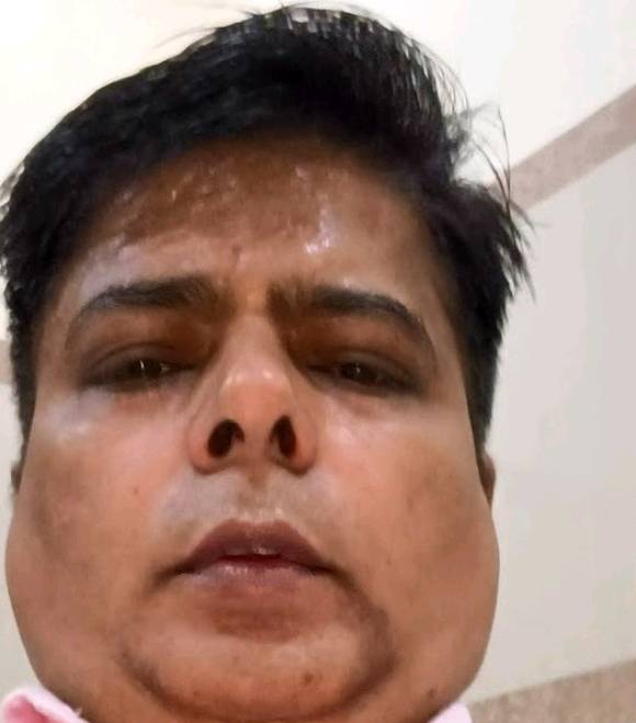 Manish Sharma